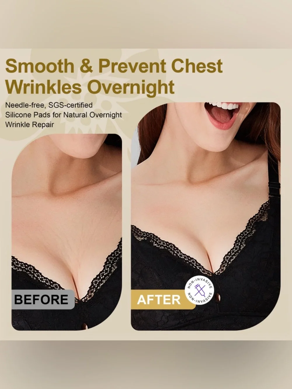 Chest Wrinkle Patches 2 Pack (30 Day Supply)